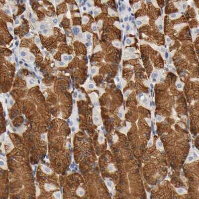 Immunohistochemistry-Paraffin: UCKL1 Antibody [NBP1-83648]