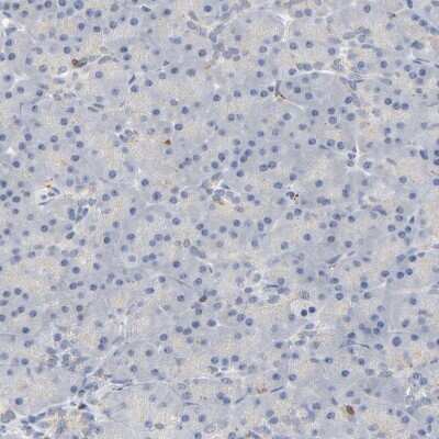 Immunohistochemistry-Paraffin: UCKL1 Antibody [NBP1-83649]