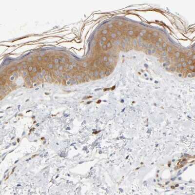 Immunohistochemistry-Paraffin: UCKL1 Antibody [NBP1-83649]