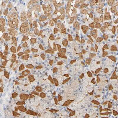 Immunohistochemistry-Paraffin: UCKL1 Antibody [NBP1-83649]