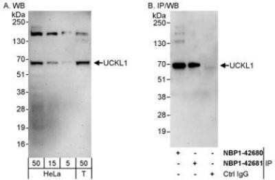 Western Blot: UCKL1 Antibody [NBP1-42680]