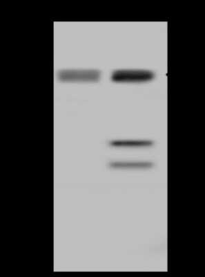 Western Blot: UCKL1 Antibody [NBP2-98566]