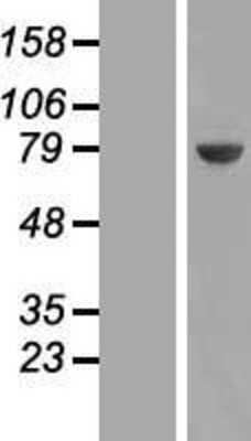 Western Blot: UCKL1 Overexpression Lysate [NBP2-06875]