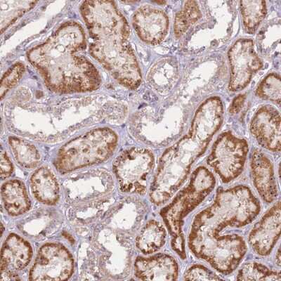 Immunohistochemistry-Paraffin: UCMA Antibody [NBP2-33469]