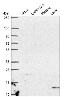 Western Blot: UCN2 Antibody [NBP2-57622]