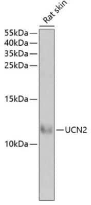 Western Blot: UCN2 AntibodyBSA Free [NBP2-94031]