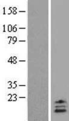 Western Blot: UCN2 Overexpression Lysate [NBL1-17581]