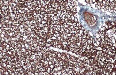 Immunohistochemistry-Paraffin: UCP1 Antibody (1345) [NBP2-43551]