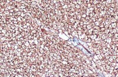Immunohistochemistry-Paraffin: UCP1 Antibody (3111) [NBP2-43550]