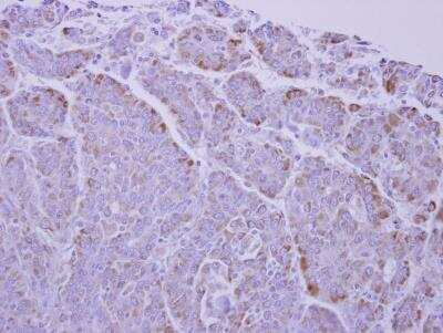 Immunohistochemistry-Paraffin: UCP1 Antibody [NBP2-20796]