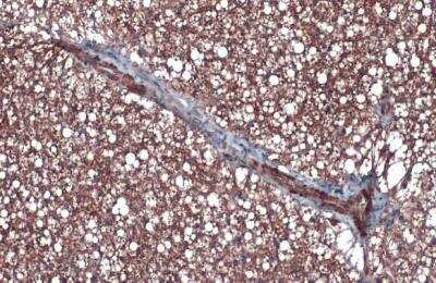 Immunohistochemistry-Paraffin: UCP1 Antibody [NBP2-20796]