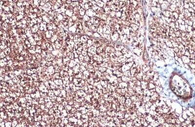 Immunohistochemistry-Paraffin: UCP1 Antibody [NBP3-13004]