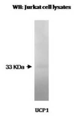 Western Blot: UCP1 Antibody (Vab12 P4B12*A12)BSA Free [NBP2-50343]