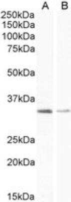 Western Blot: UCP1 Antibody [NB100-2828]