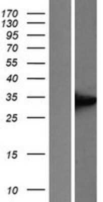 Western Blot: UCP1 Overexpression Lysate [NBP2-06511]