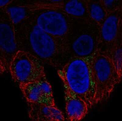 Immunocytochemistry/ Immunofluorescence: UCP2 Antibody [NBP2-69001]