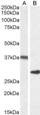 Western Blot: UCP2 Antibody [NB100-59742]