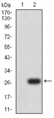 Western Blot: UCP3 Antibody (6B8C6)BSA Free [NBP2-61821]