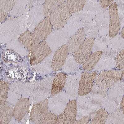 Immunohistochemistry-Paraffin: UCP3 Antibody [NBP2-58840]