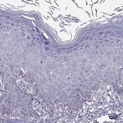 Immunohistochemistry-Paraffin: UCP3 Antibody [NBP2-58840]