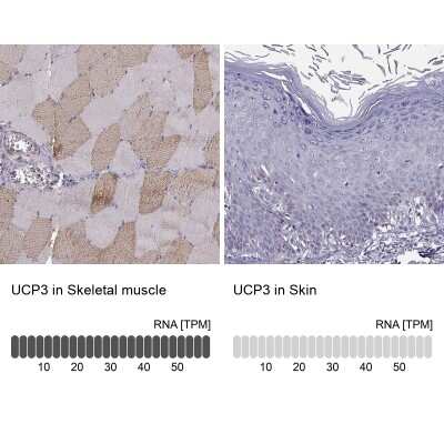 Immunohistochemistry-Paraffin: UCP3 Antibody [NBP2-58840]