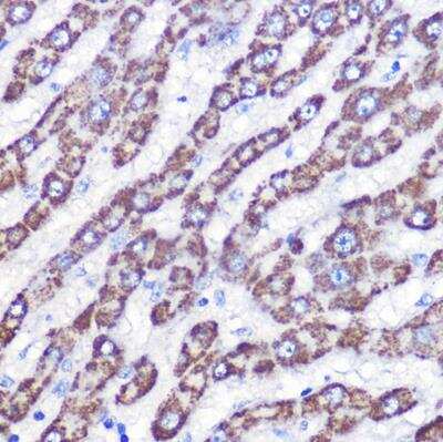 Immunohistochemistry-Paraffin: UCP3 Antibody - Azide and BSA Free [NBP2-94835]
