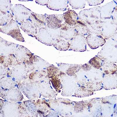 Immunohistochemistry-Paraffin: UCP3 Antibody - Azide and BSA Free [NBP2-94835]