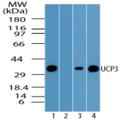 Western Blot: UCP3 Antibody [NBP2-24608]