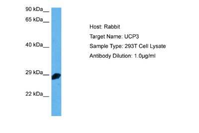 Western Blot: UCP3 Antibody [NBP2-88547]