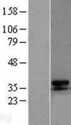 Western Blot: UCP3 Overexpression Lysate [NBL1-17583]