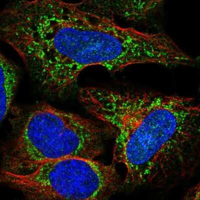 Immunocytochemistry/ Immunofluorescence: UCP4 Antibody [NBP2-57763]