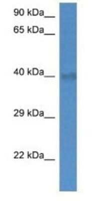 Western Blot: UCP4 Antibody [NBP1-80525]