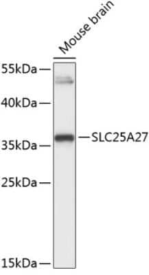 Western Blot: UCP4 AntibodyAzide and BSA Free [NBP2-94702]