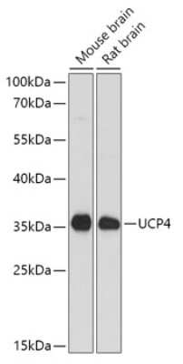 Western Blot: UCP4 AntibodyAzide and BSA Free [NBP2-94703]