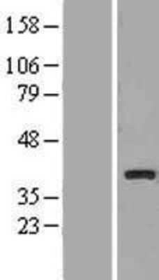 Western Blot: UCP4 Overexpression Lysate [NBP2-10579]