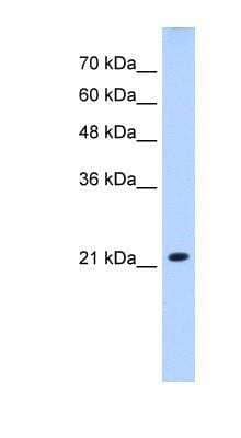 Western Blot: UCP5 Antibody [NBP1-59598]