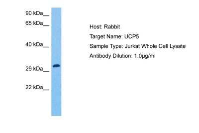 Western Blot: UCP5 Antibody [NBP2-88548]