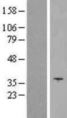 Western Blot: UCP5 Overexpression Lysate [NBP2-10555]