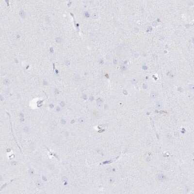 Immunohistochemistry-Paraffin: UDP glucose dehydrogenase Antibody [NBP1-90906]