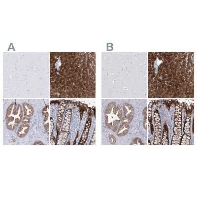 Immunohistochemistry-Paraffin: UDP glucose dehydrogenase Antibody [NBP1-90906]