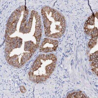 Immunohistochemistry-Paraffin: UDP glucose dehydrogenase Antibody [NBP1-90906]