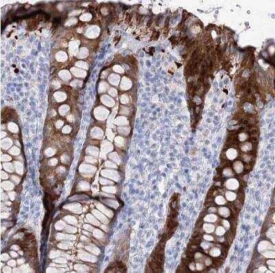 Immunohistochemistry-Paraffin: UDP glucose dehydrogenase Antibody [NBP1-90906]