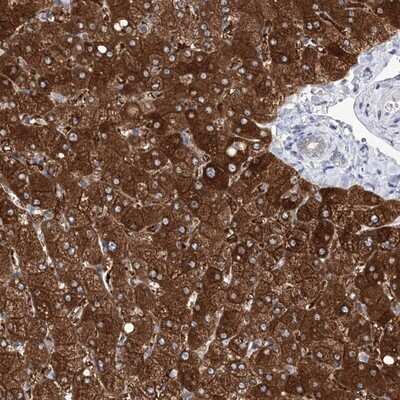 Immunohistochemistry-Paraffin: UDP glucose dehydrogenase Antibody [NBP1-90997]