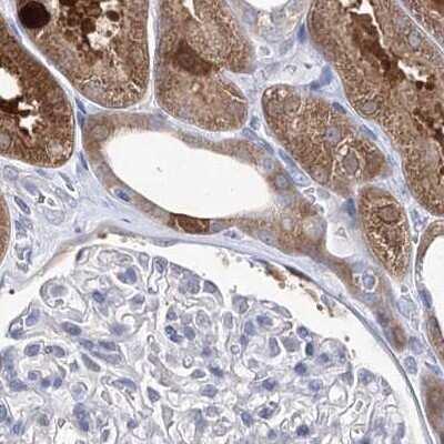 Immunohistochemistry-Paraffin: UDP glucose dehydrogenase Antibody [NBP1-90997]
