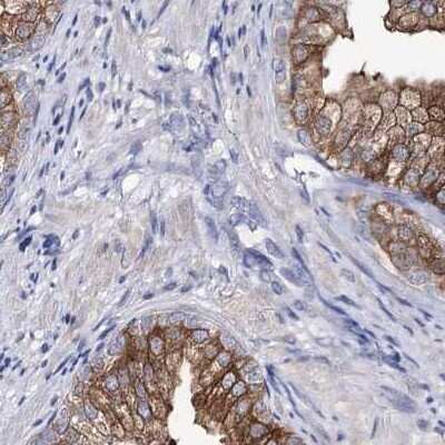 Immunohistochemistry-Paraffin: UDP glucose dehydrogenase Antibody [NBP1-90997]