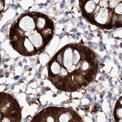 Immunohistochemistry-Paraffin: UDP glucose dehydrogenase Antibody [NBP1-90997]