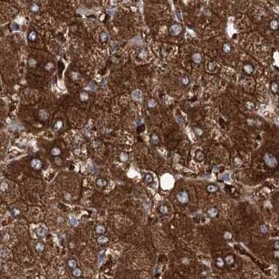 Immunohistochemistry-Paraffin: UDP glucose dehydrogenase Antibody [NBP1-90997]
