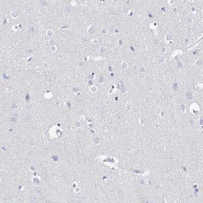 Immunohistochemistry-Paraffin: UDP glucose dehydrogenase Antibody [NBP1-90997]