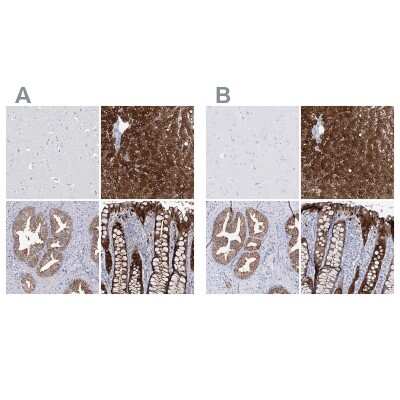 Immunohistochemistry-Paraffin: UDP glucose dehydrogenase Antibody [NBP1-90997]