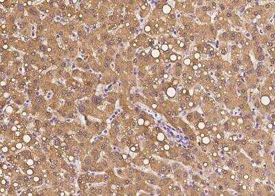 Immunohistochemistry-Paraffin: UDP glucose dehydrogenase Antibody [NBP3-06479]